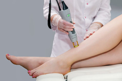 Dermatologie laser